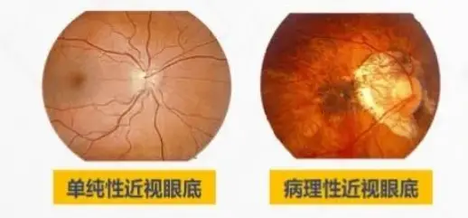 健康的生活方式缺点有哪些_缺点健康方式生活有哪些方面_身心健康缺点