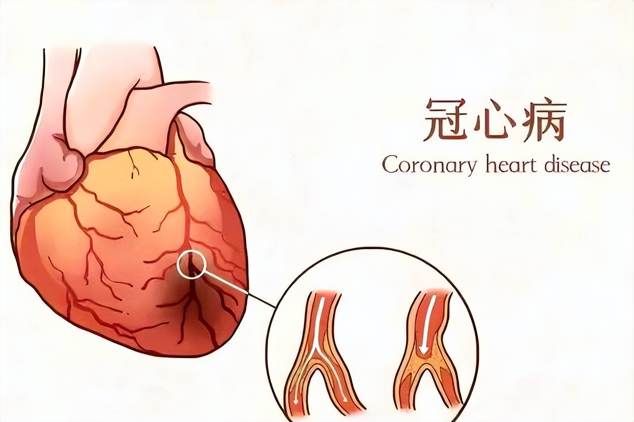 年轻人最普遍的生活方式_年轻人生活方式有哪些类型_101种年轻人的生活方式