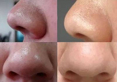 生活小常识1000条_生活常识小知识_为生活而生活的小常识