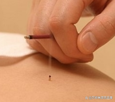 艾灸的基本原则_艾灸基本常识是什么_艾灸的主要事项