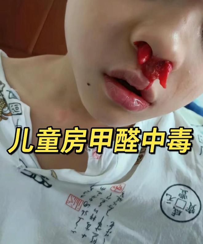 甲醛日常检测家庭方法有哪些_简单甲醛检测方法_家庭检测甲醛日常方法